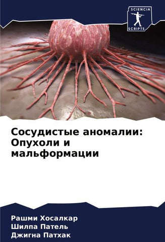 Sosudistye anomalii: Opuholi i mal'formacii