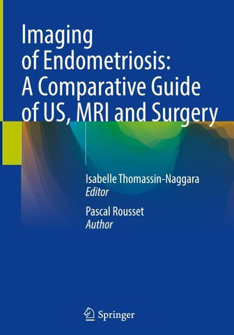 Imaging of Endometriosis: A Comparative Guide of US, MRI and Surgery