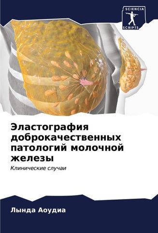 Jelastografiq dobrokachestwennyh patologij molochnoj zhelezy