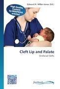 Cleft Lip and Palate