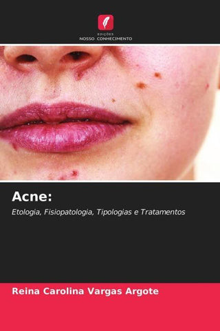 Acne: