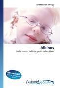 Albinos