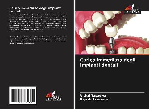 Carico immediato degli impianti dentali