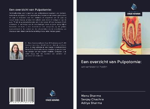 Een overzicht van Pulpotomie: