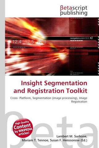 Insight Segmentation and Registration Toolkit