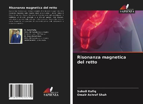 Risonanza magnetica del retto