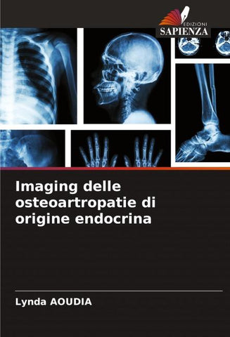 Imaging delle osteoartropatie di origine endocrina