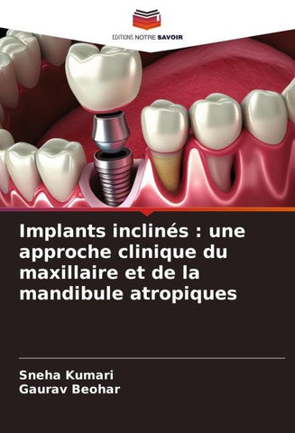 Implants inclinés : une approche clinique du maxillaire et de la mandibule atropiques