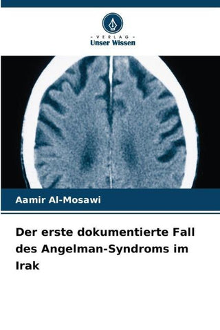 Der erste dokumentierte Fall des Angelman-Syndroms im Irak
