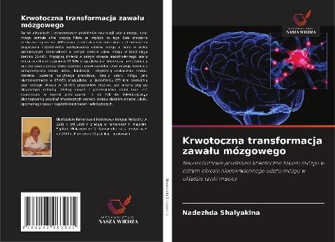 Krwotoczna transformacja zawa¿u mózgowego