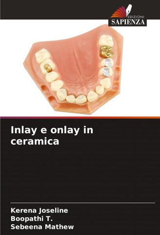 Inlay e onlay in ceramica