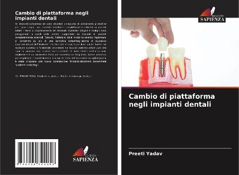 Cambio di piattaforma negli impianti dentali