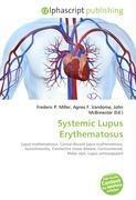 Systemic Lupus Erythematosus