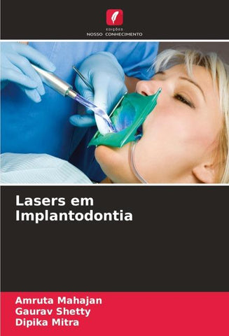 Lasers em Implantodontia
