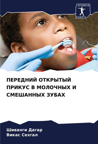 PEREDNIJ OTKRYTYJ PRIKUS V MOLOChNYH I SMEShANNYH ZUBAH