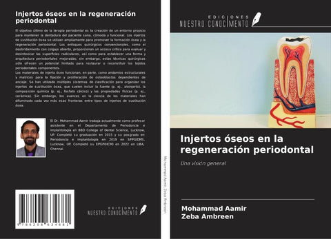 Injertos óseos en la regeneración periodontal