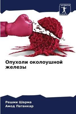 Opuholi okoloushnoj zhelezy