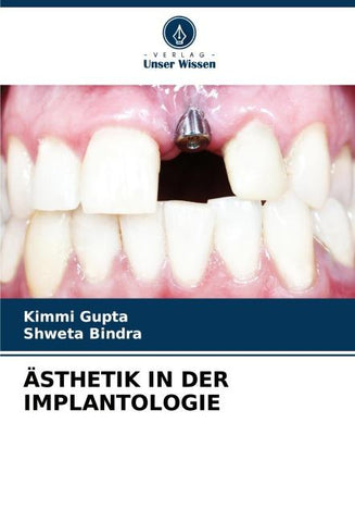 ÄSTHETIK IN DER IMPLANTOLOGIE