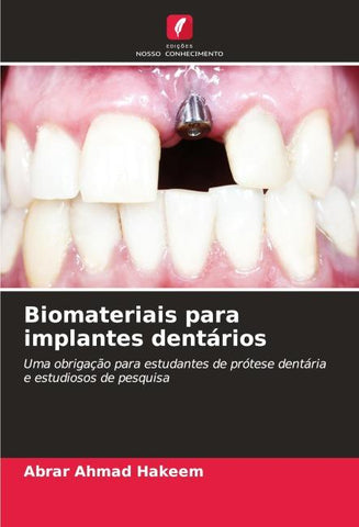 Biomateriais para implantes dentários