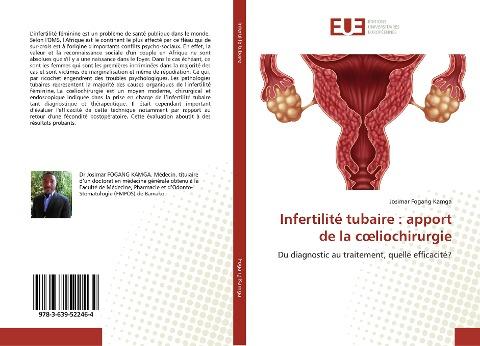 Infertilité tubaire : apport de la c¿liochirurgie