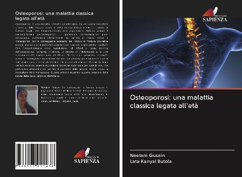Osteoporosi: una malattia classica legata all'età