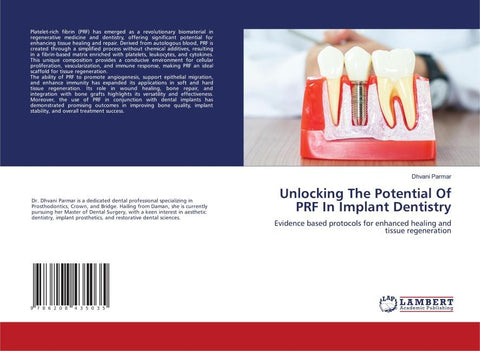 Unlocking The Potential Of PRF In Implant Dentistry