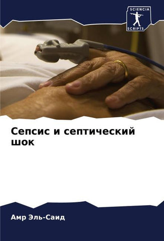 Sepsis i septicheskij shok