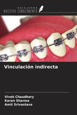 Vinculación indirecta