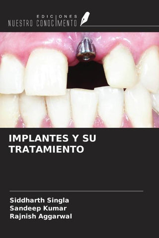 IMPLANTES Y SU TRATAMIENTO