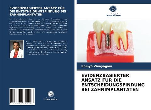 EVIDENZBASIERTER ANSATZ FÜR DIE ENTSCHEIDUNGSFINDUNG BEI ZAHNIMPLANTATEN
