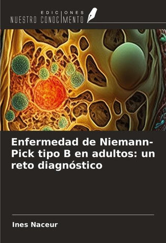 Enfermedad de Niemann-Pick tipo B en adultos: un reto diagnóstico