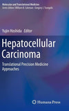 Hepatocellular Carcinoma