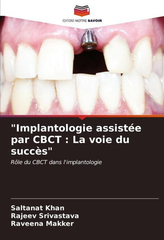"Implantologie assistée par CBCT : La voie du succès"