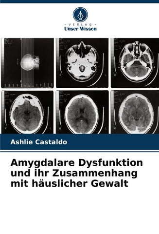 Amygdalare Dysfunktion und ihr Zusammenhang mit häuslicher Gewalt