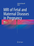 MRI of Fetal and Maternal Diseases in Pregnancy
