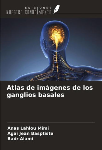 Atlas de imágenes de los ganglios basales