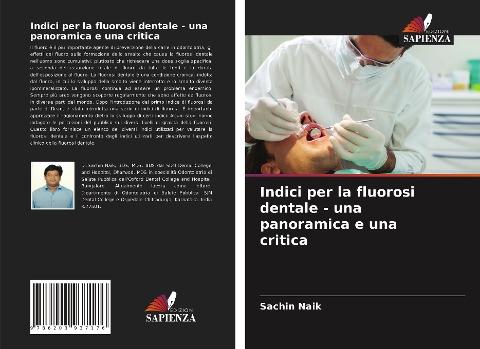 Indici per la fluorosi dentale - una panoramica e una critica