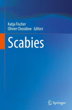 Scabies