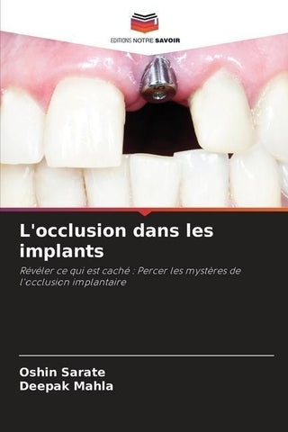 L'occlusion dans les implants