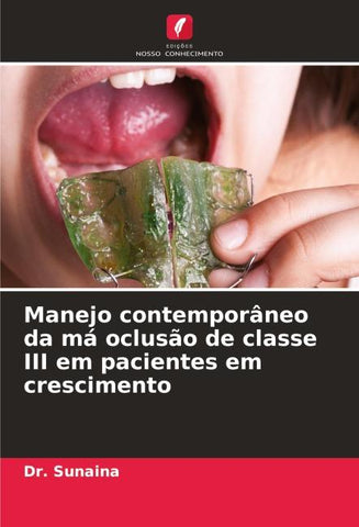 Manejo contemporâneo da má oclusão de classe III em pacientes em crescimento