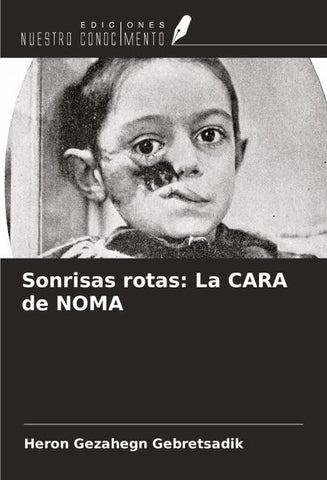 Sonrisas rotas: La CARA de NOMA