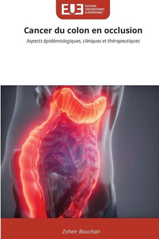 Cancer du colon en occlusion