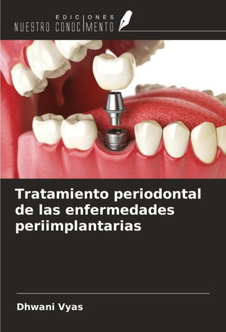 Tratamiento periodontal de las enfermedades periimplantarias