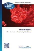 Thrombosis