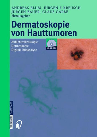 Dermatoskopie von Hauttumoren
