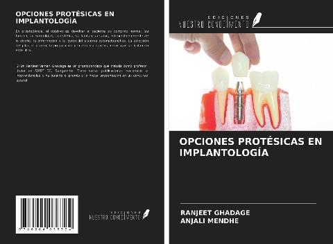 OPCIONES PROTÉSICAS EN IMPLANTOLOGÍA