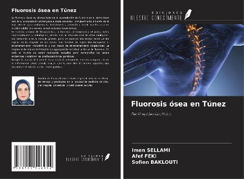 Fluorosis ósea en Túnez