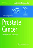 Prostate Cancer