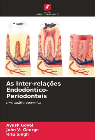 As Inter-relações Endodôntico-Periodontais