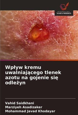 Wp¿yw kremu uwalniaj¿cego tlenek azotu na gojenie si¿ odle¿yn